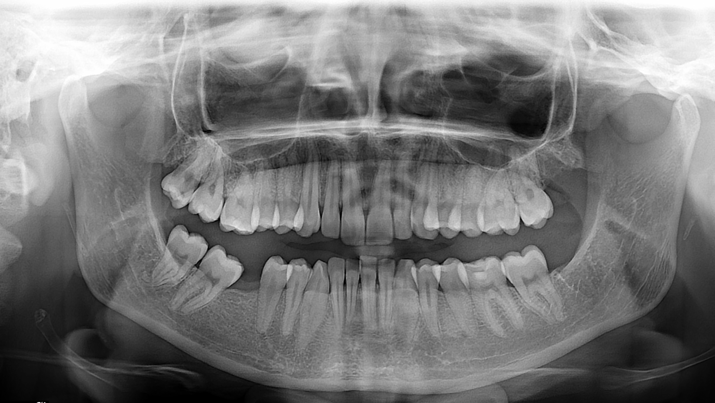 Pantomogram Poznań