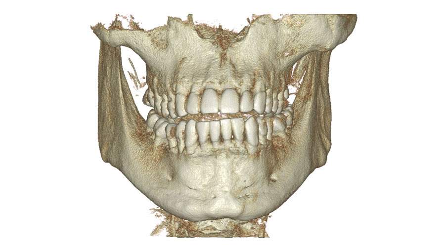 Tomografia szczęki i żuchwy Poznań